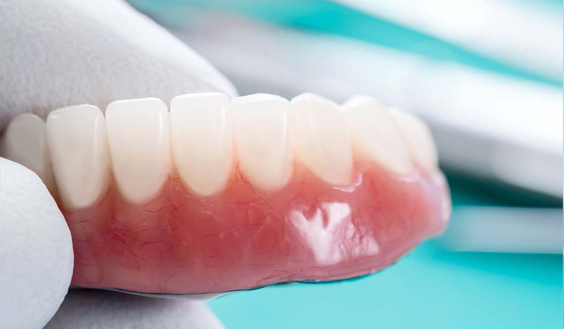 Dental Prosthetics